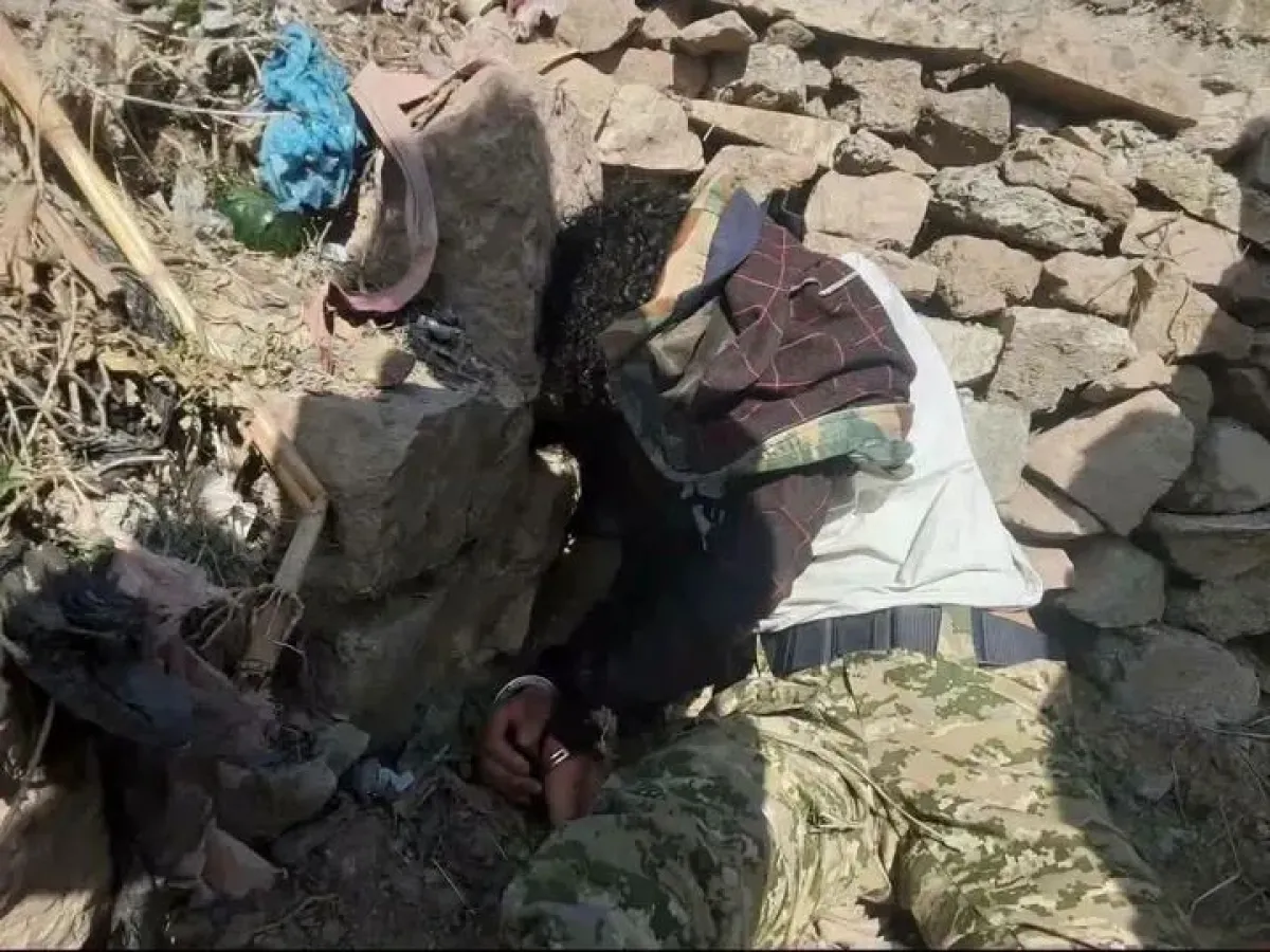 Houthi Forces Brutally Assault Citizen in Ibb Over Business Dispute