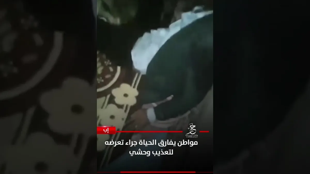 إب.. مواطن يفارق الحياة جراء تعرضه لتعذيب وحشي