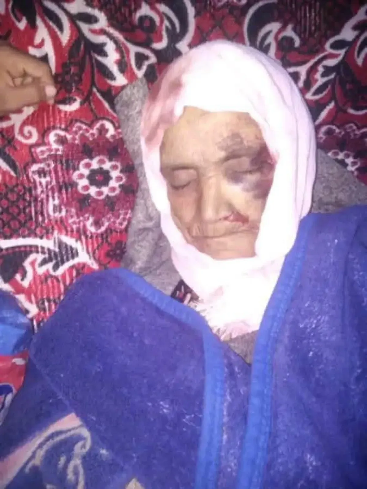 Elderly Woman Dies, Daughter Injured in Yemen Home Collapse Due to Heavy Rains