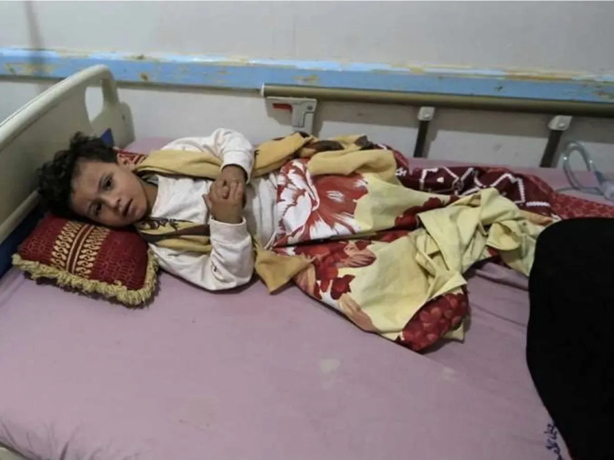 إحصائية: أكثر من 16 ألف إصابة بالحصبة و93 وفاة في مناطق الحكومة خلال 7 أشهر